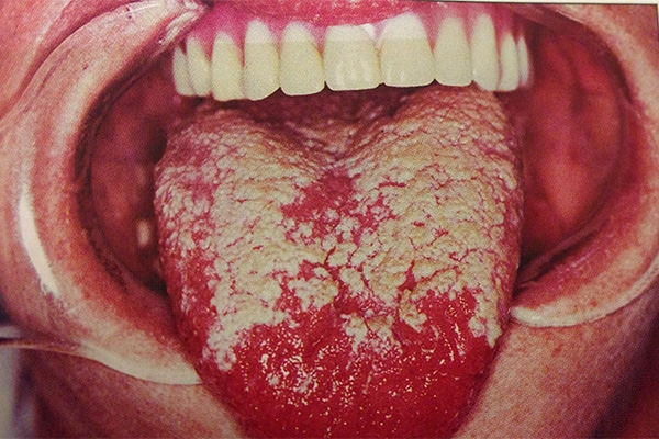 Medicina Oral