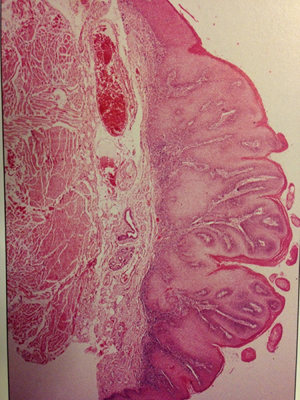 Patología Oral